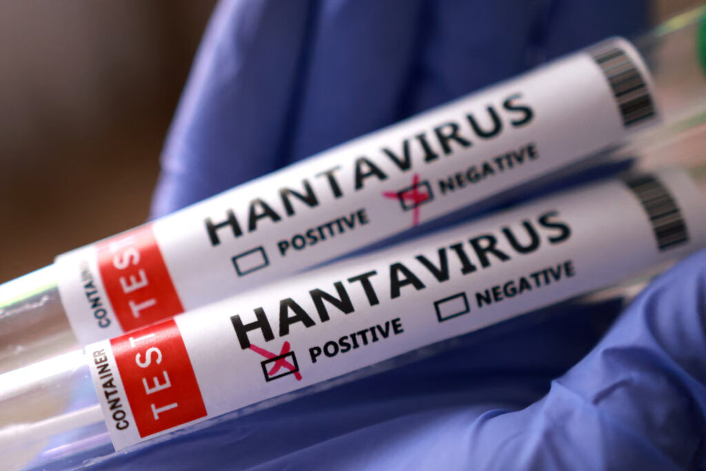 Vendi me raste rekorde të hantavirusit  shkencëtarët gjejnë shkaktarin