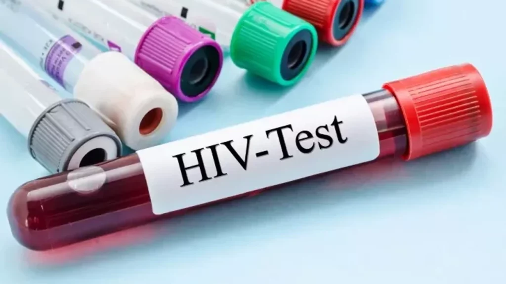 Dhjetë raste të reja me HIV  dy viktima  rritet testimi vullnetar